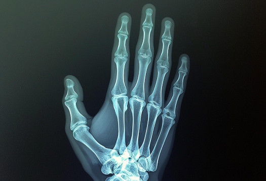 x ray ruka